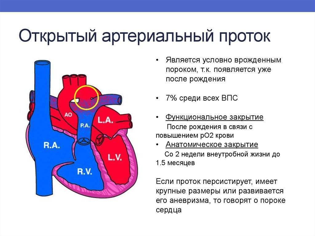 Мрт и кт детям. кт и мрт диагностика открытого артериального протока сердца у детей