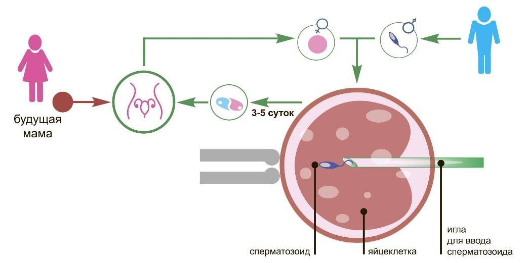 Заморозка яйцеклеток: как происходит - статья репродуктивного центра «за рождение»