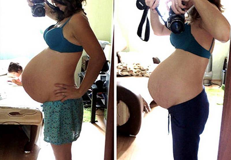 Чего ожидать, когда опускается живот у беременных?