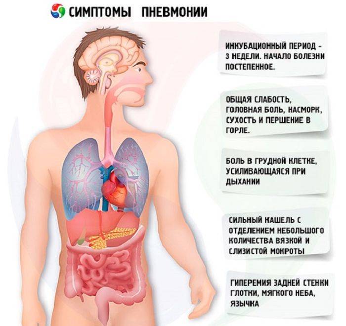 Симптомы и лечение пневмонии: атипичной, вирусной и других форм