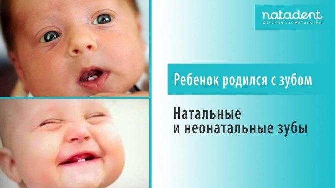 Отвечаем на вопрос: почему ребенок родился с зубами. почему рождаются дети с зубами