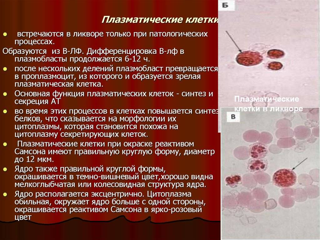 Плазматические клетки в крови у ребенка