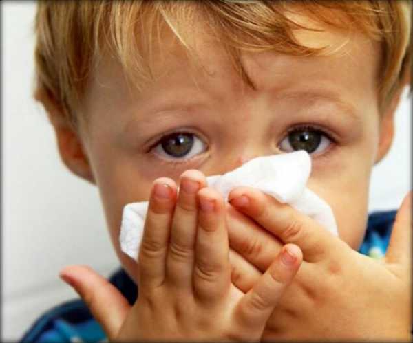 Полипы носа - все о заболевании: причины, симптомы, лечение