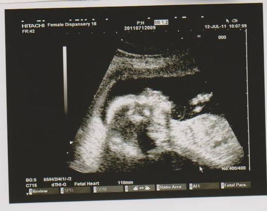 Узи на 14 неделе беременности: фото, показатели, нормы