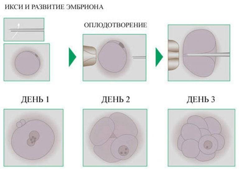 Искусственное оплодотворение - цена, искусственная инсеминация донорской спермой в москве