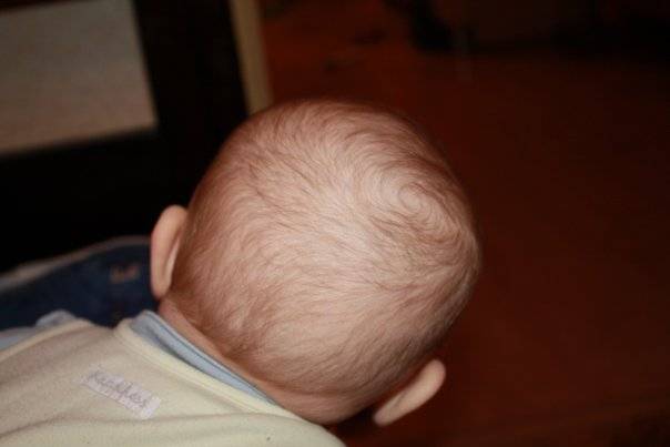Выпадение волос после родов. как восстановить волосы после родов