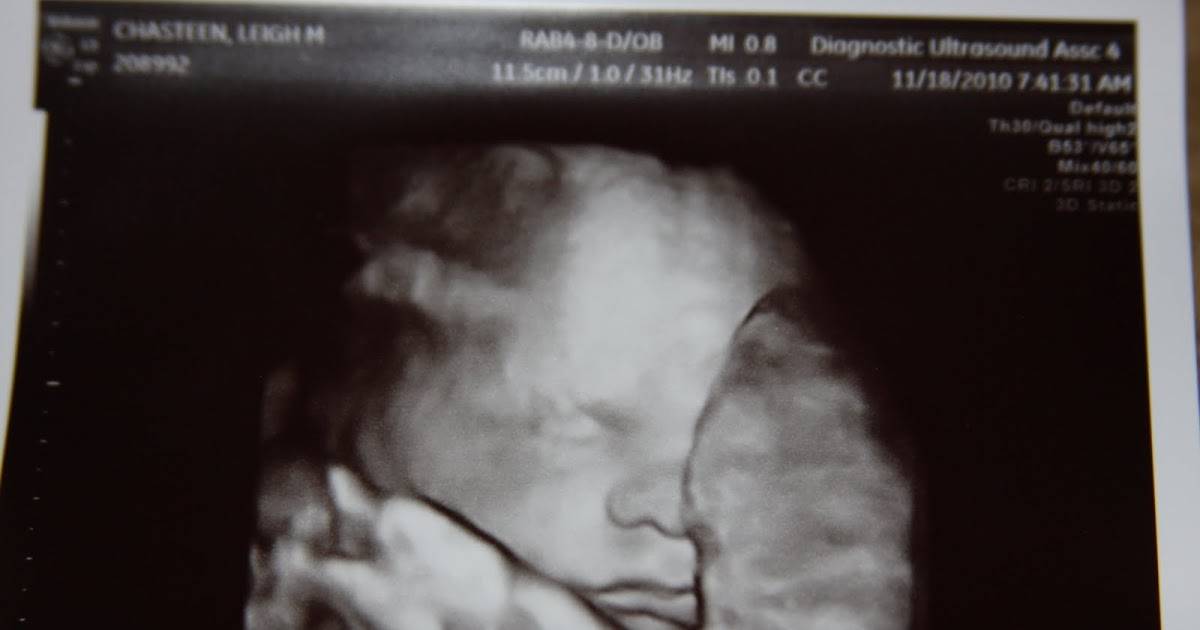 19 неделя беременности – что происходит с малышом (18 фото): развитие плода и ощущения ребенка, размер и вес в норме, где находится и как выглядит