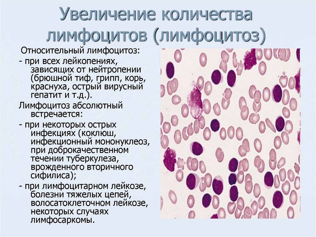 Синусит у детей: лечение и симптомы