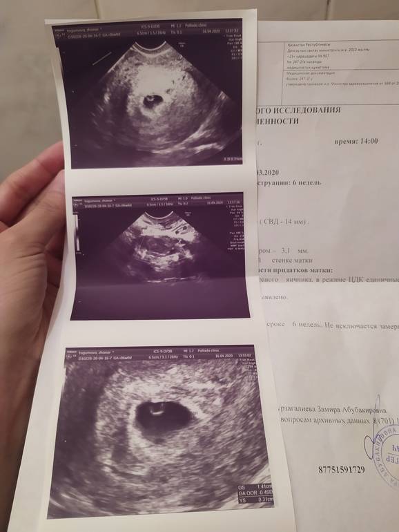 Вторая неделя беременности: признаки, что происходит с животом, показывает ли тест, фото узи