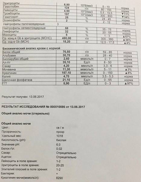 Эритроциты в моче: расшифрвка у взрослых и при беременности